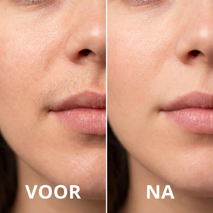 Ontharingsolie – Natuurlijk zacht en haarvrij